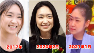 池脇千鶴が老けて顔変わった？原因は病気？昔と現在を画像比較！