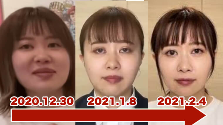 画像比較|エミリンの激痩せがヤバい…原因は炎上ストレス&整形?